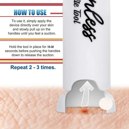 Suction Tool, Remover - Bug Bites and Bee/Wasp Stings, Natural Insect Bite Relief, Chemical Free Single